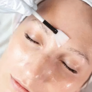 Reciclagem Peeling Químico